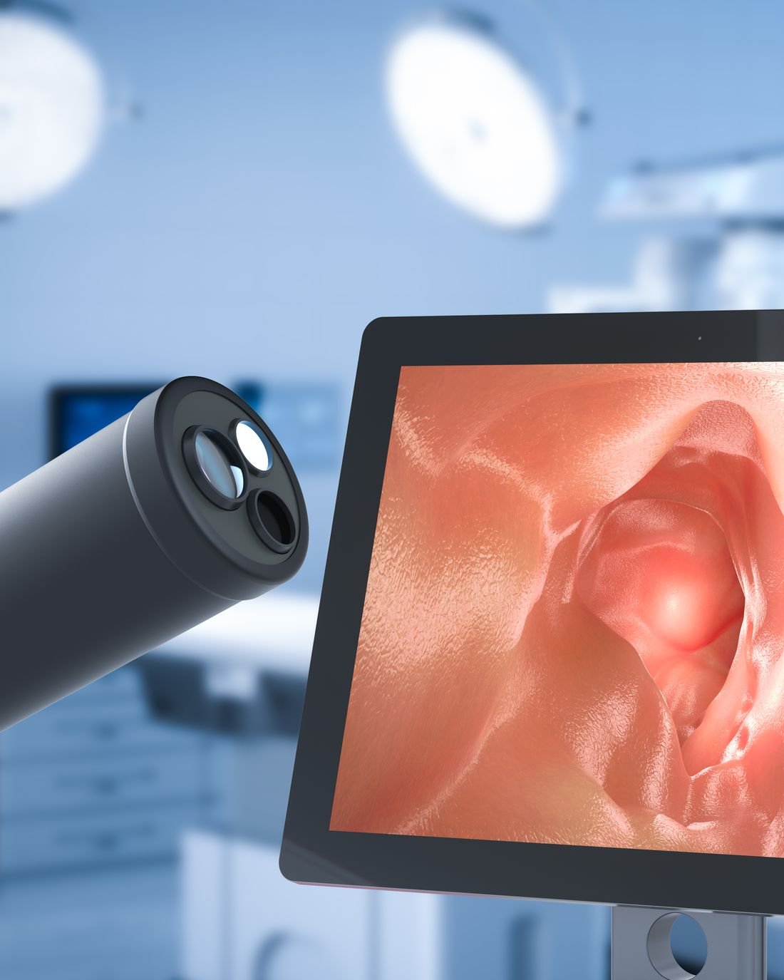 Monitor endoscópico durante un procedimiento urológico